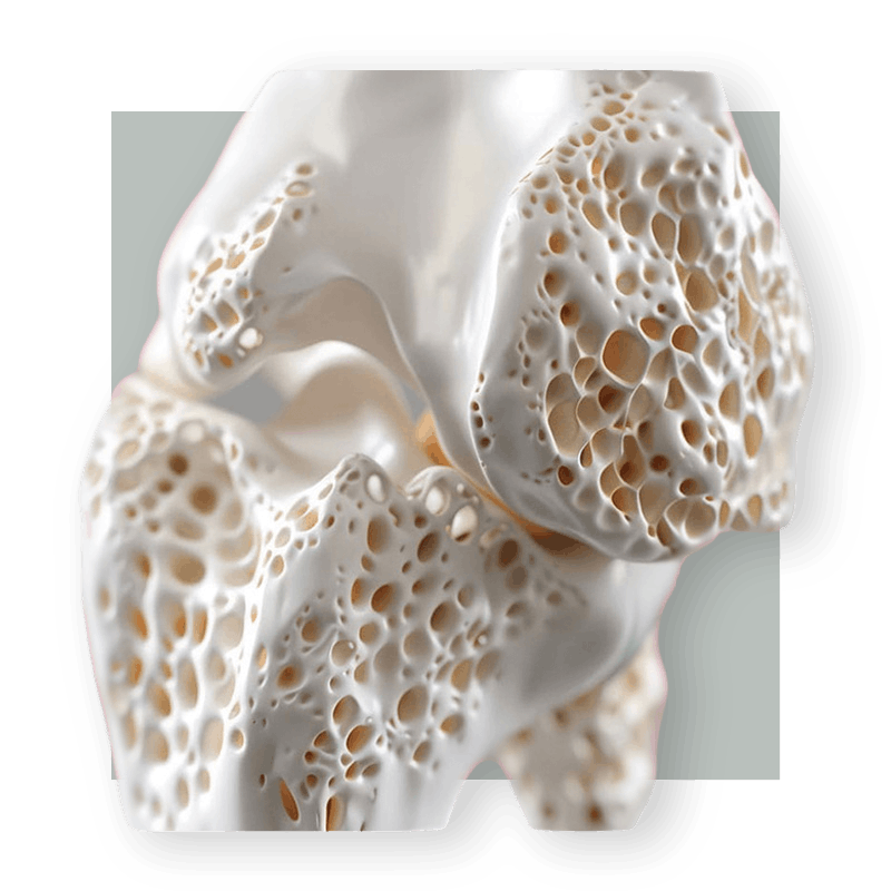 image of bone