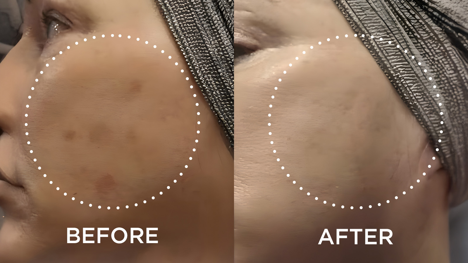 Side by side of woman's face before & after
